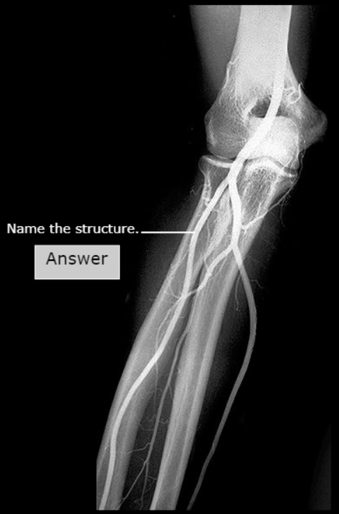 <p>What artery is this</p>