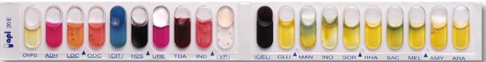 <p>gram negative, oxidase negative bacteria in the enterobacerales family </p><ul><li><p>generate a 7 digit profile number and reference that with API database</p></li><li><p>to set up each strip is inoculated with bacterial suspension and incubated</p></li><li><p>benefits are very easy, quick, highly standardized, and only small amount of culture needed</p></li></ul><p></p><p></p>