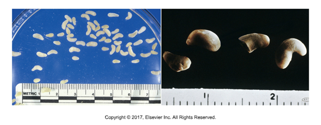 <p>“Rumen fluke”</p><ul><li><p>1st intermediate host: aquatic snail​</p></li><li><p>No 2nd intermediate host: metacercariae bind to vegetation​</p></li><li><p>Cause of infection: Ruminants eat vegetation</p></li><li><p>“Amphistome” means 2 mouths. Obvious oral sucker on one end and ventral sucker is at opposite end.​</p></li><li><p>Adults are not pathogenic, but migration of young flukes can cause problems as they eat the intestinal lining​</p></li><li><p>Not zoonotic</p></li></ul><p></p>