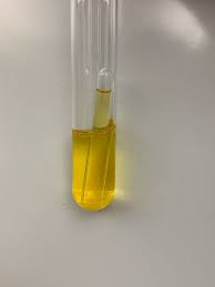 <p>What results can you gather from this Durham tube?</p>