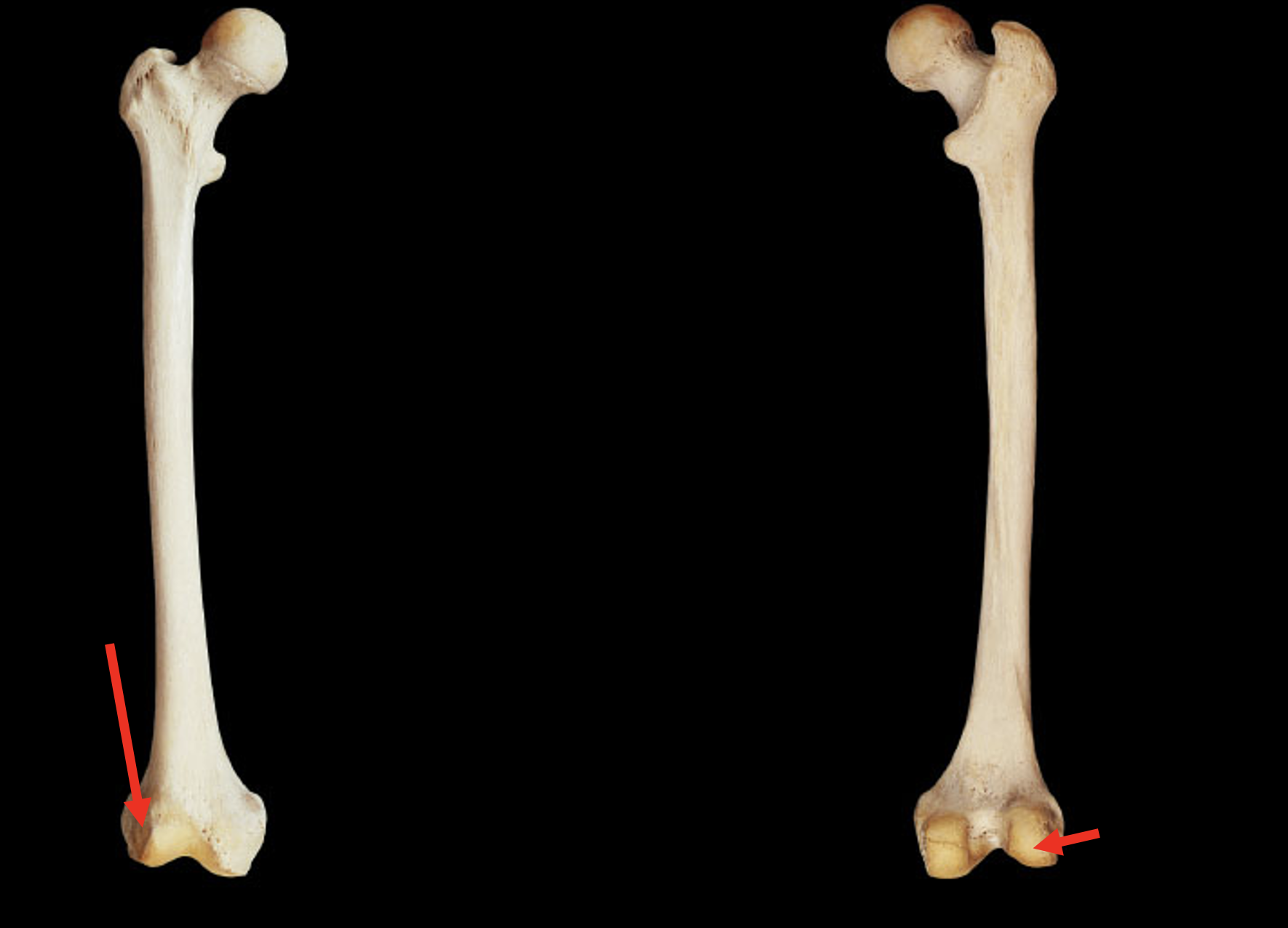 <p>Name this region of the femur</p>