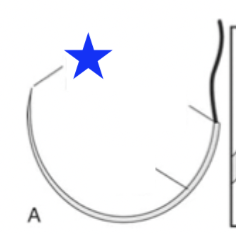 <p>What part of the surgical needle is indicated by the blue star?</p>