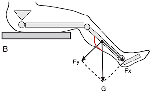 <p>Gravity on knee joint at 135 degrees, gravity’s parallel force pulls lower leg away from femur</p>