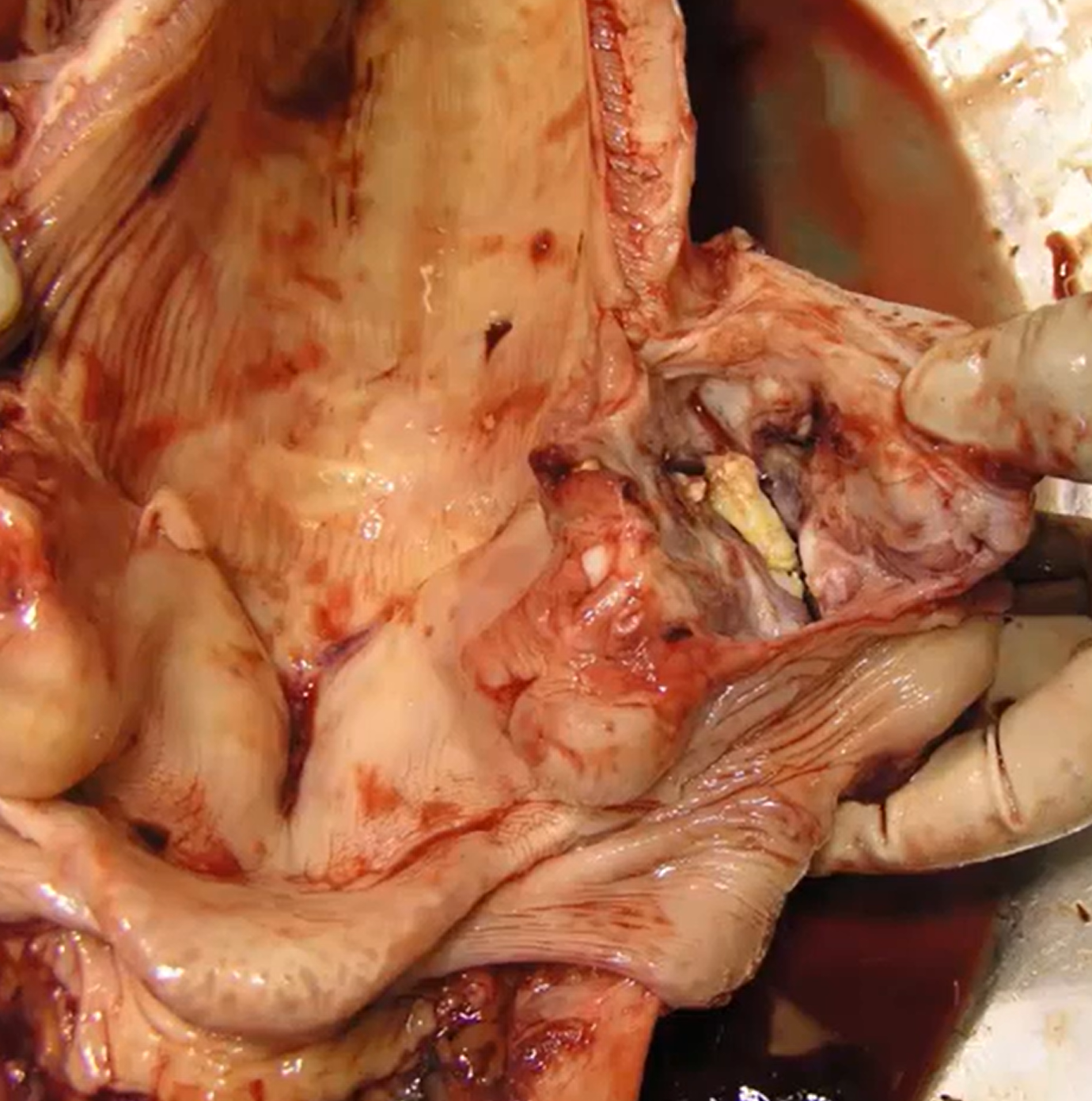 <p>Calf. MDX and two possible causes. </p>