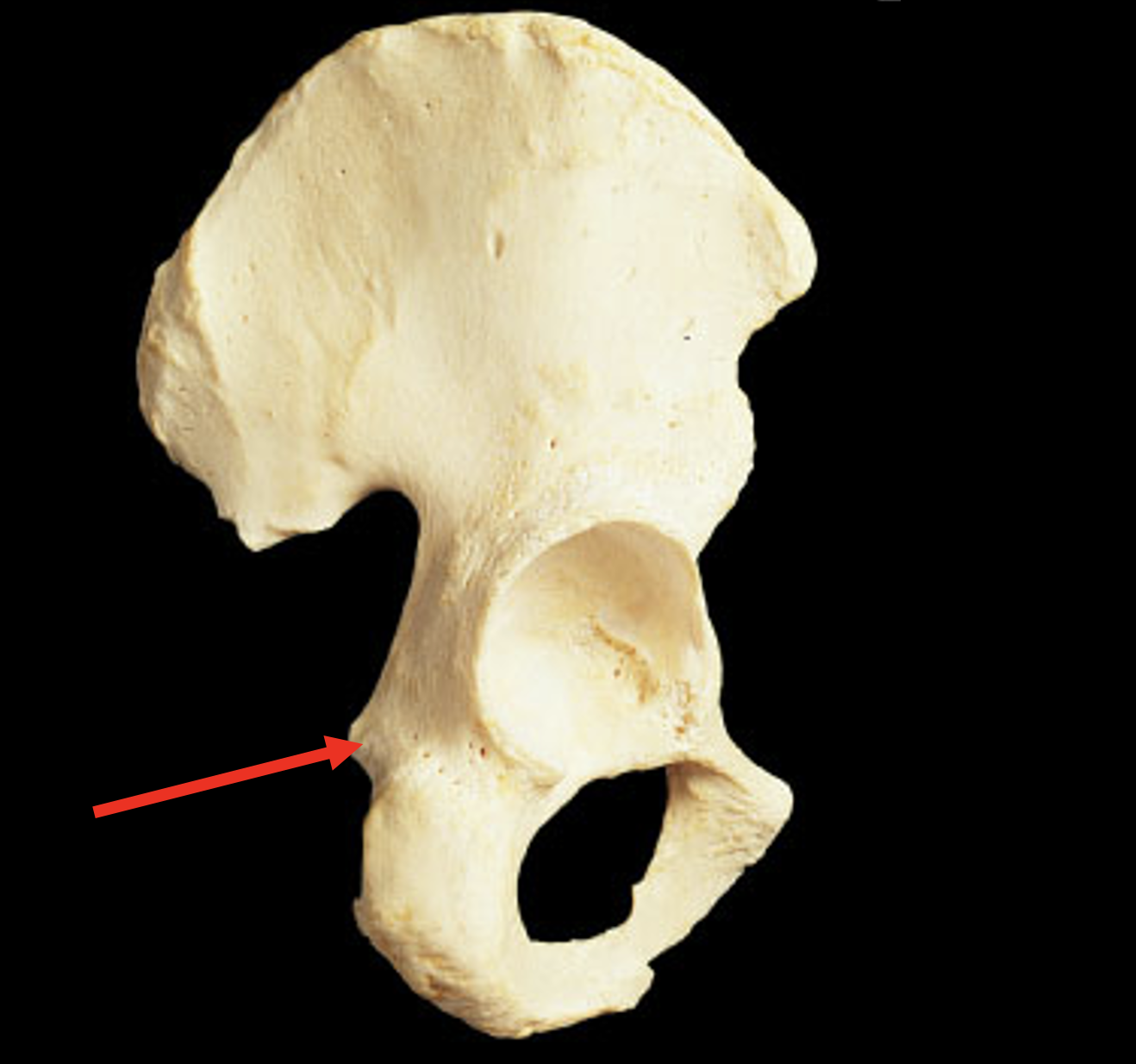 Name this region of the pelvis