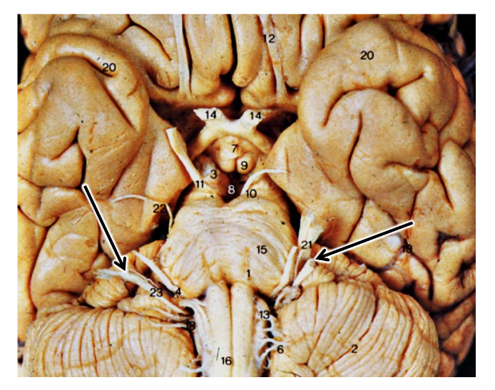 <p>what are the arrows pointing at?</p>