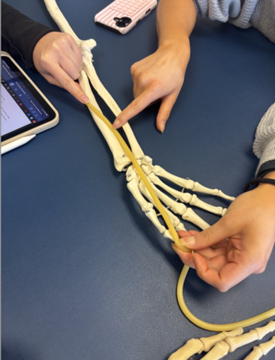 <p>What is this muscle?</p>