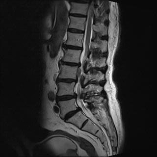 <p>Name the main pathology.</p>