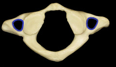 <p>only found in the cervical vertebrae and allow passage of the vertabral artery, vein, and nerve</p>