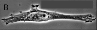 <p><span>Visualizes transparent objects by converting differences in refractive index of some parts of the specimen into light intensity differences</span></p>