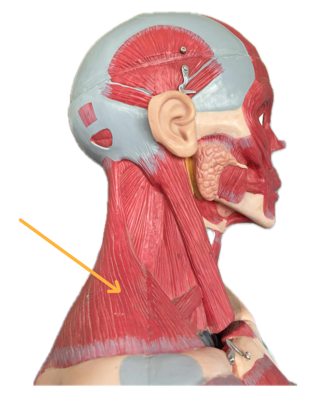 term image