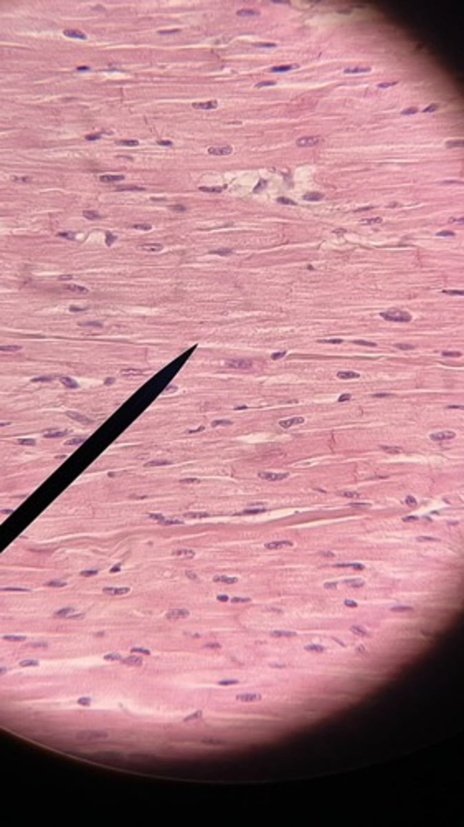 <p>Involuntary muscle tissue found only in the heart.</p>