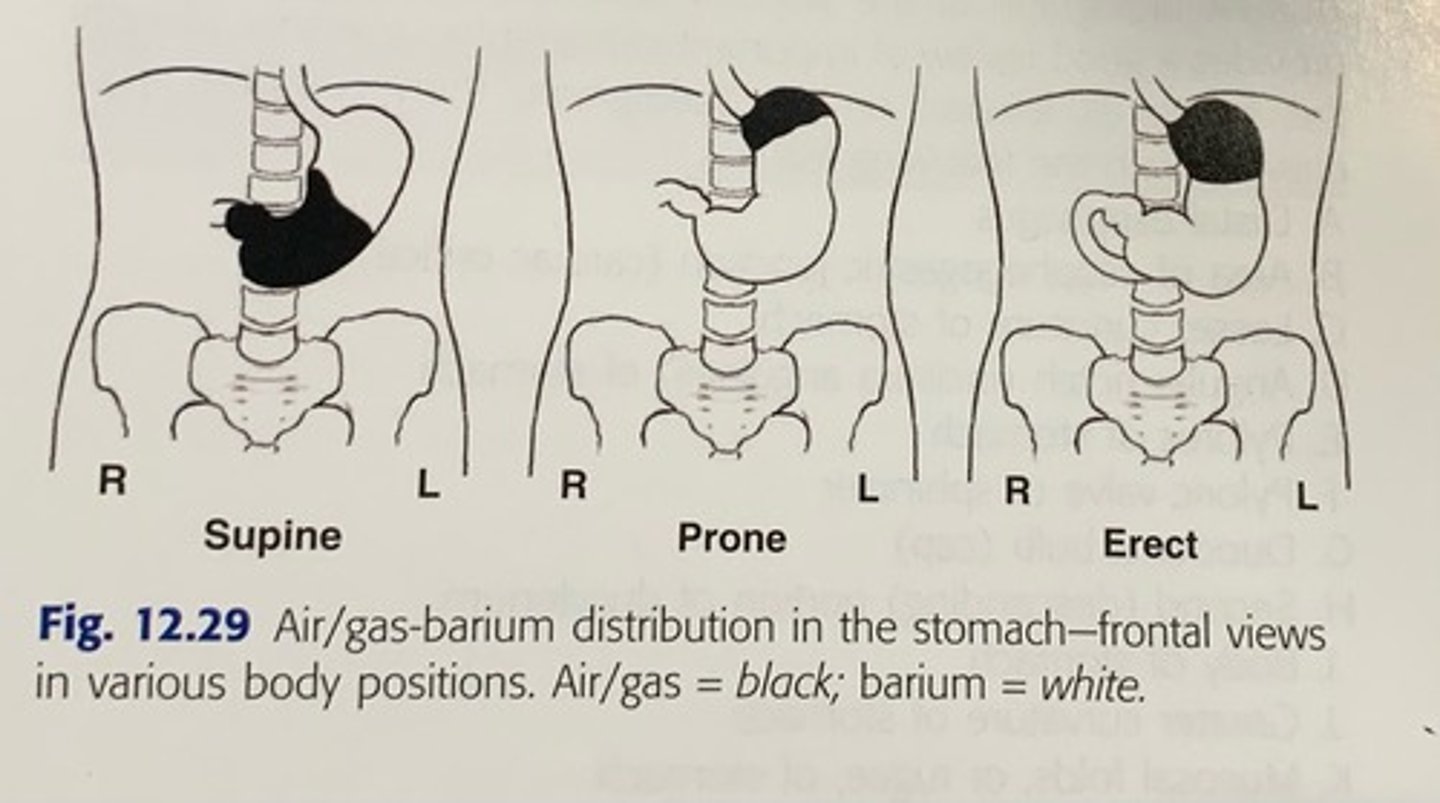 <p>When supine (AP) - barium in fundus and pylorus, air in body</p><p>When prone (PA) - air in fundus, barium in body and pylorus</p><p>When erect - air in fundus, barium in body and pylorus</p><p>RAO - barium in body and pylorus</p><p>LPO - barium in fundus</p>