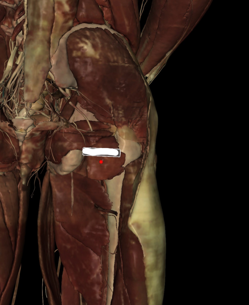 <p>Identify the Structure</p>