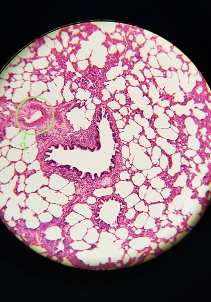 <p>what is outlined?</p>