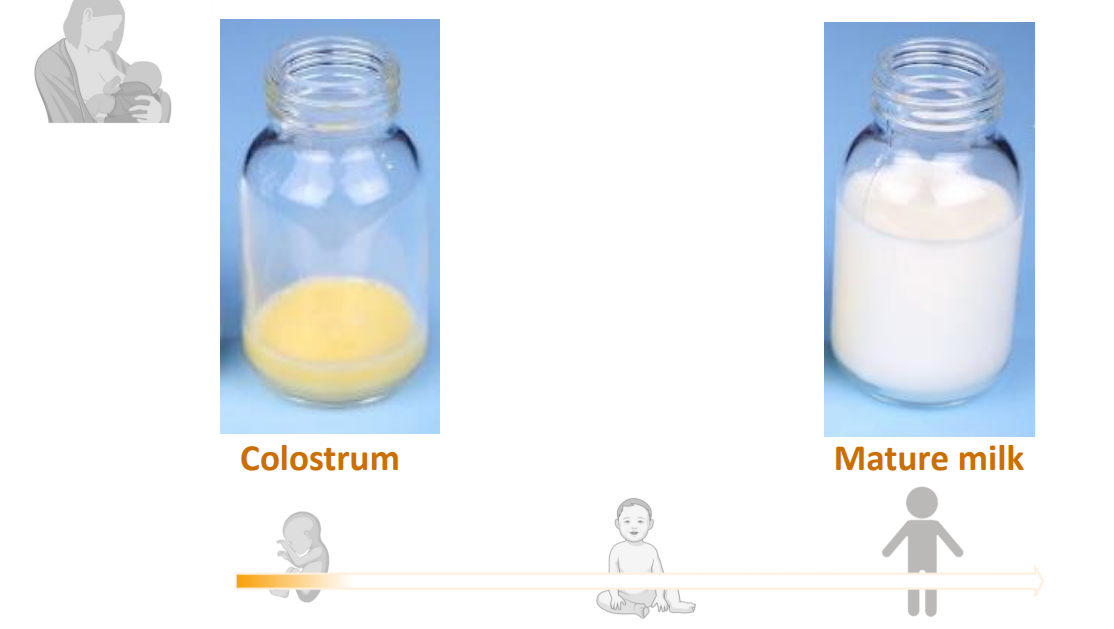 <p>- Colostrum</p><p>- Mature Milk</p><p>.</p><p>- during pregnancy the intestine grows by 50% as an adult and you generate new tissue</p><p>- breast is creating ductic alveoli, a lot you create new tissue</p><ul><li><p>Colostrum is yellow because of its high beta-carotene content, while mature milk is white due to its balanced composition of fats, proteins, and carbohydrates that are essential for the growing baby's nutritional needs. This color change signifies the milk's transition from colostrum to transitional milk and then to mature milk, adapting to the baby's increasing demands for calories and other nutrients</p></li></ul><p></p>