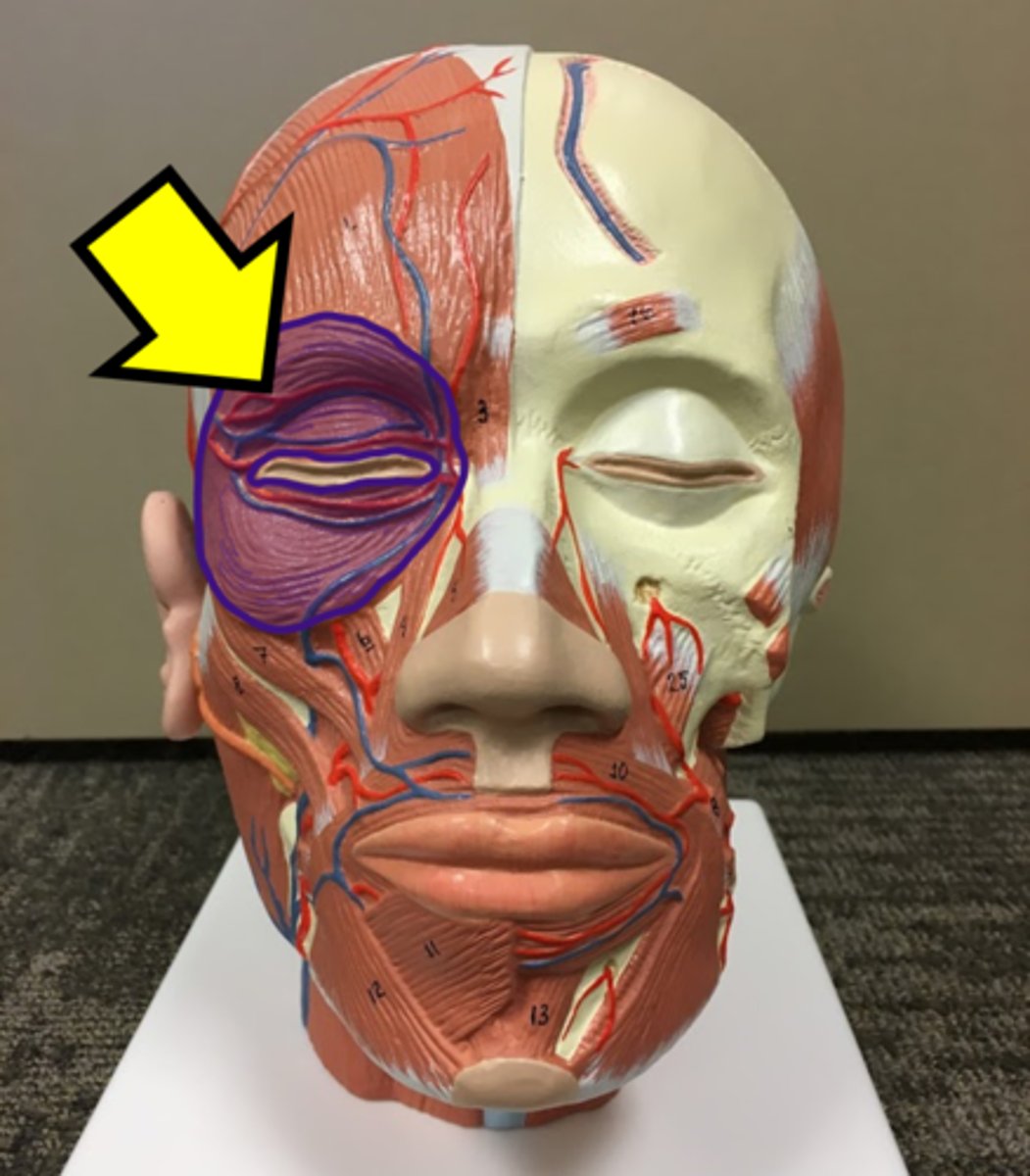 <p>Name the muscle.</p>