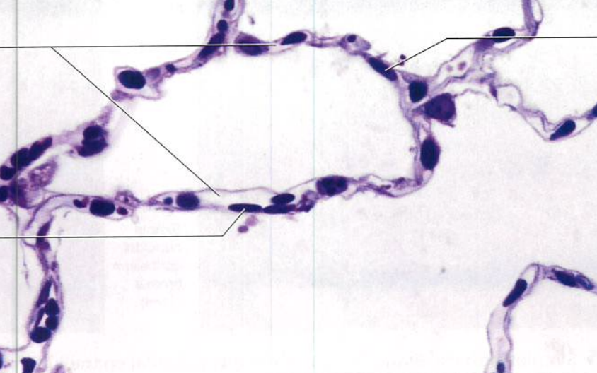 <p>What type of tissue type is in this image?</p>