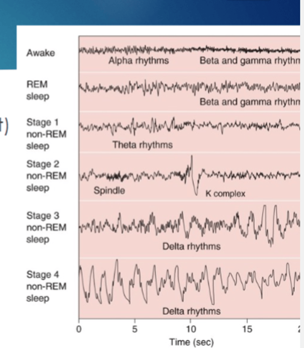 <p>Transitional sleep (few minutes & lightest)</p><p>Slightly deeper (5-15 minutes)sleep spindles & K complex</p><p>Delta rhythms, deeper sleep</p><p>Deepest sleep (20-40 min)Slow large amplitude delta waves</p>