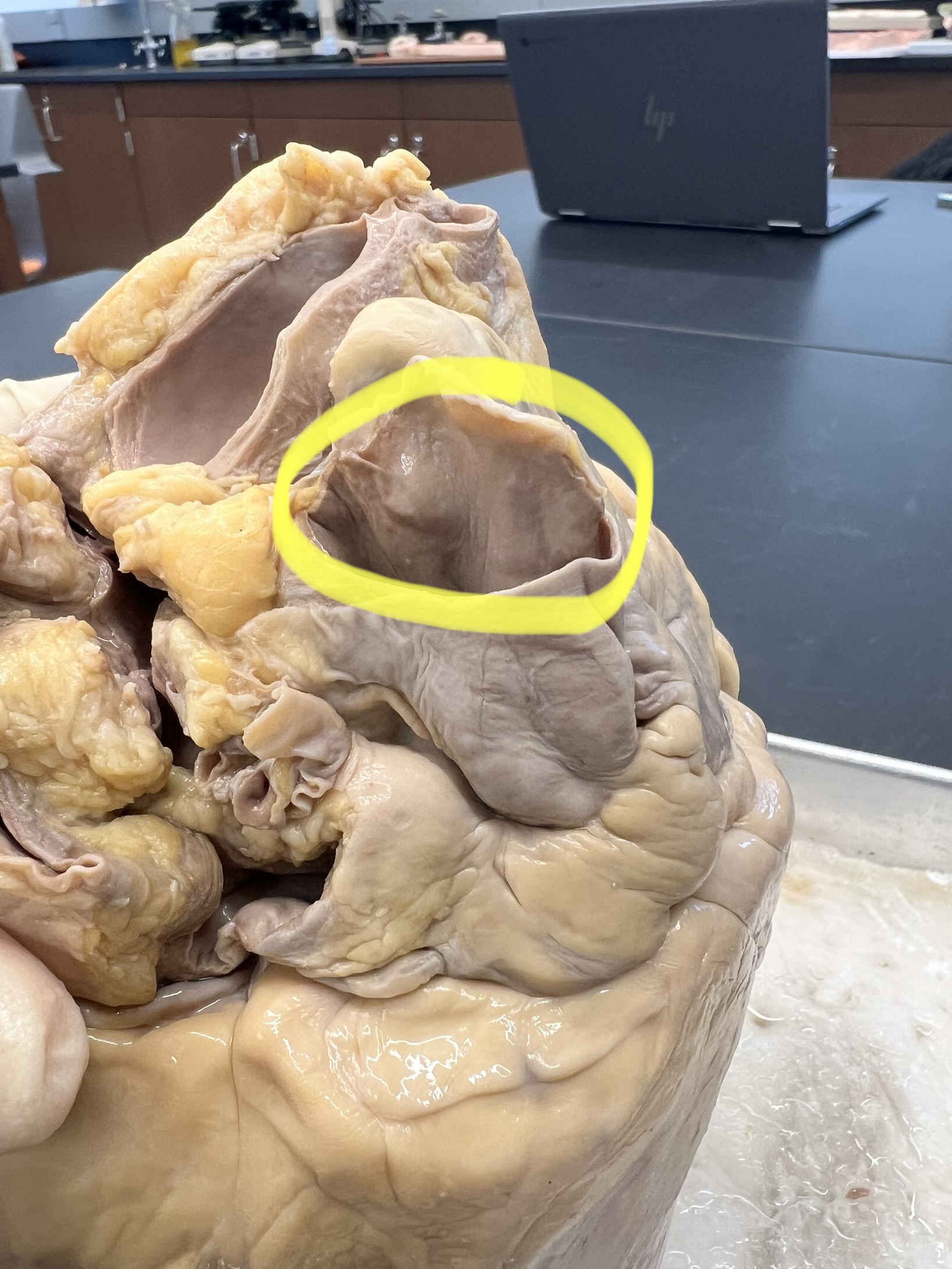 Name the heart structure.