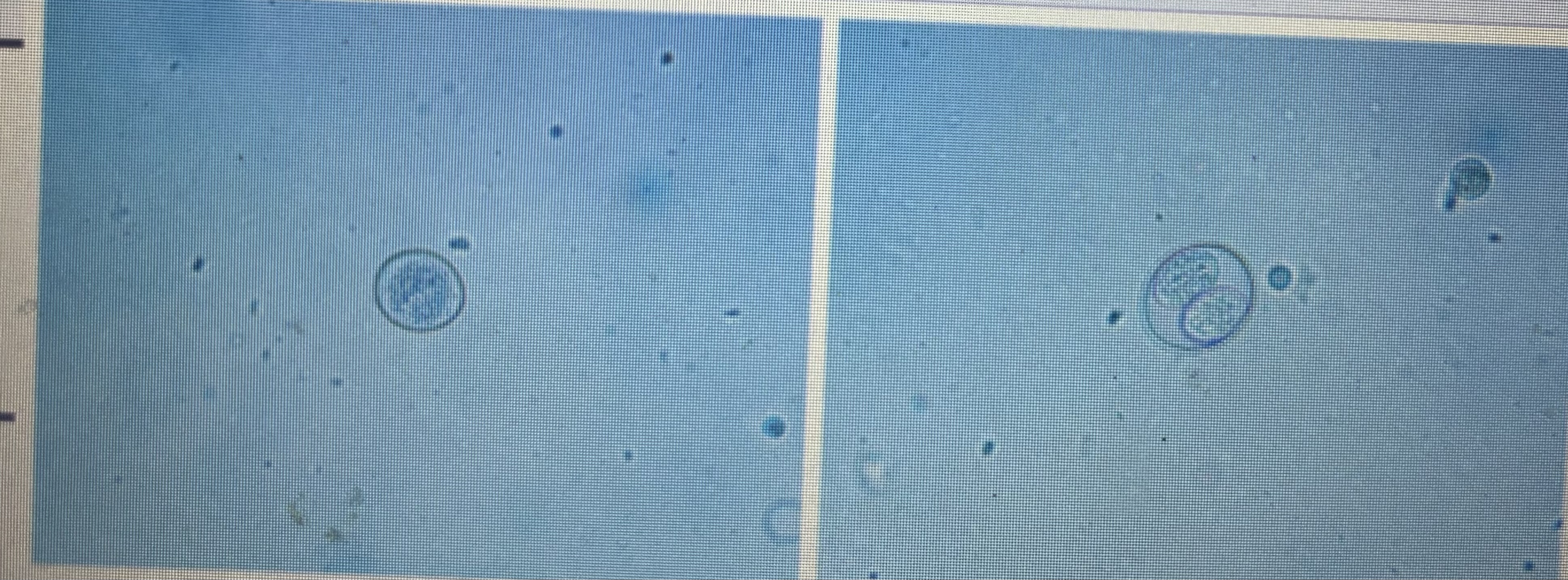<p>Direct life cycle with situated form </p><p>Prepatent period 7-14 days </p>