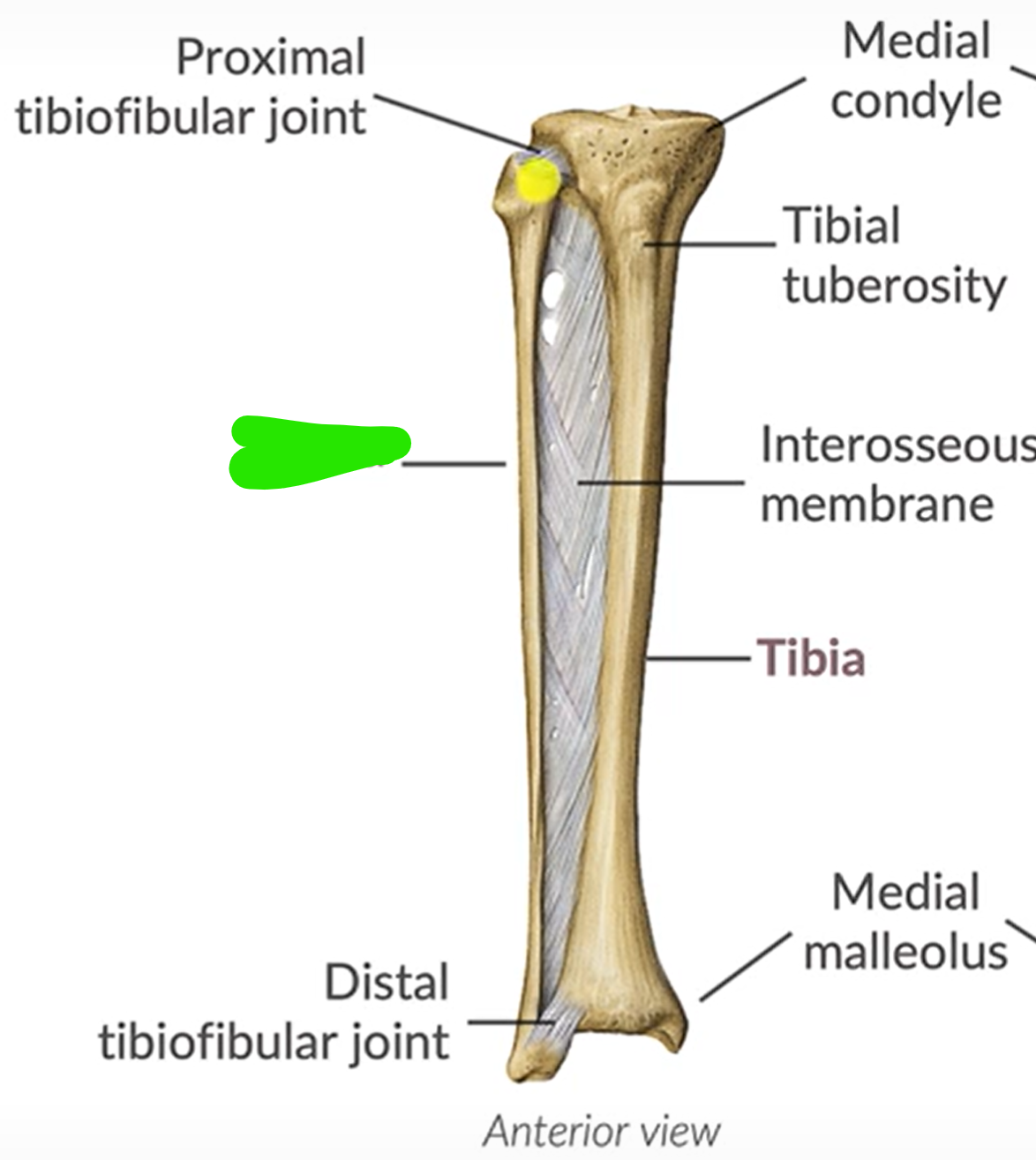 term image