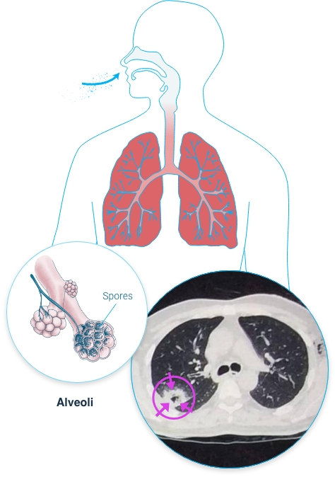 <p>What to keep in mind if getting a culture of Aspergillus?</p>