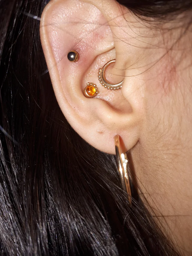 <p>Immediately anterior to the helix, fold of tissue marking entrance to the concha. </p>