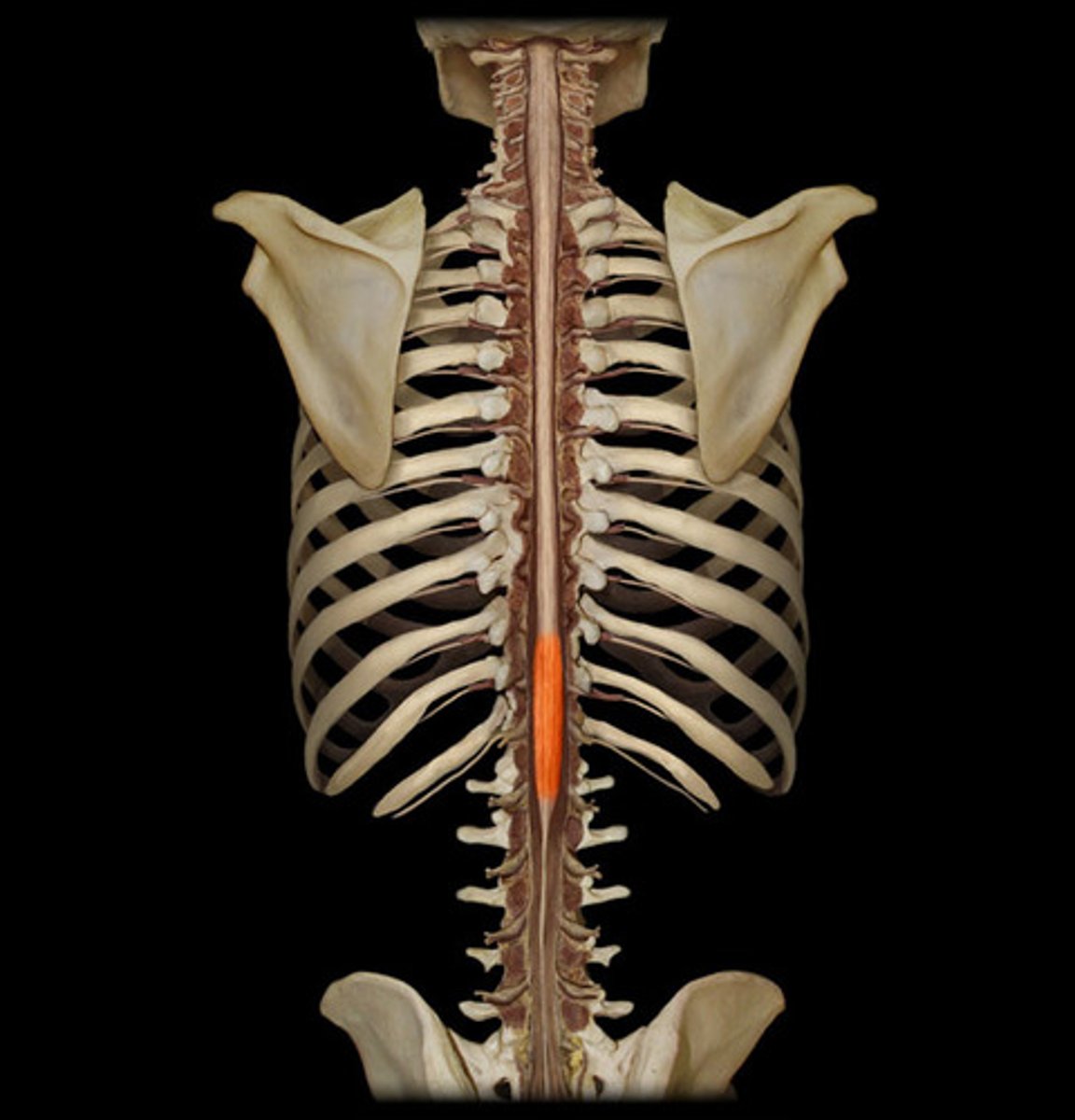 <p>Enlargement of the spinal cord in the lumbar region. Location where nerves serving the pelvis and lower limbs arise.<br><br>Right above the conus medullaris</p>