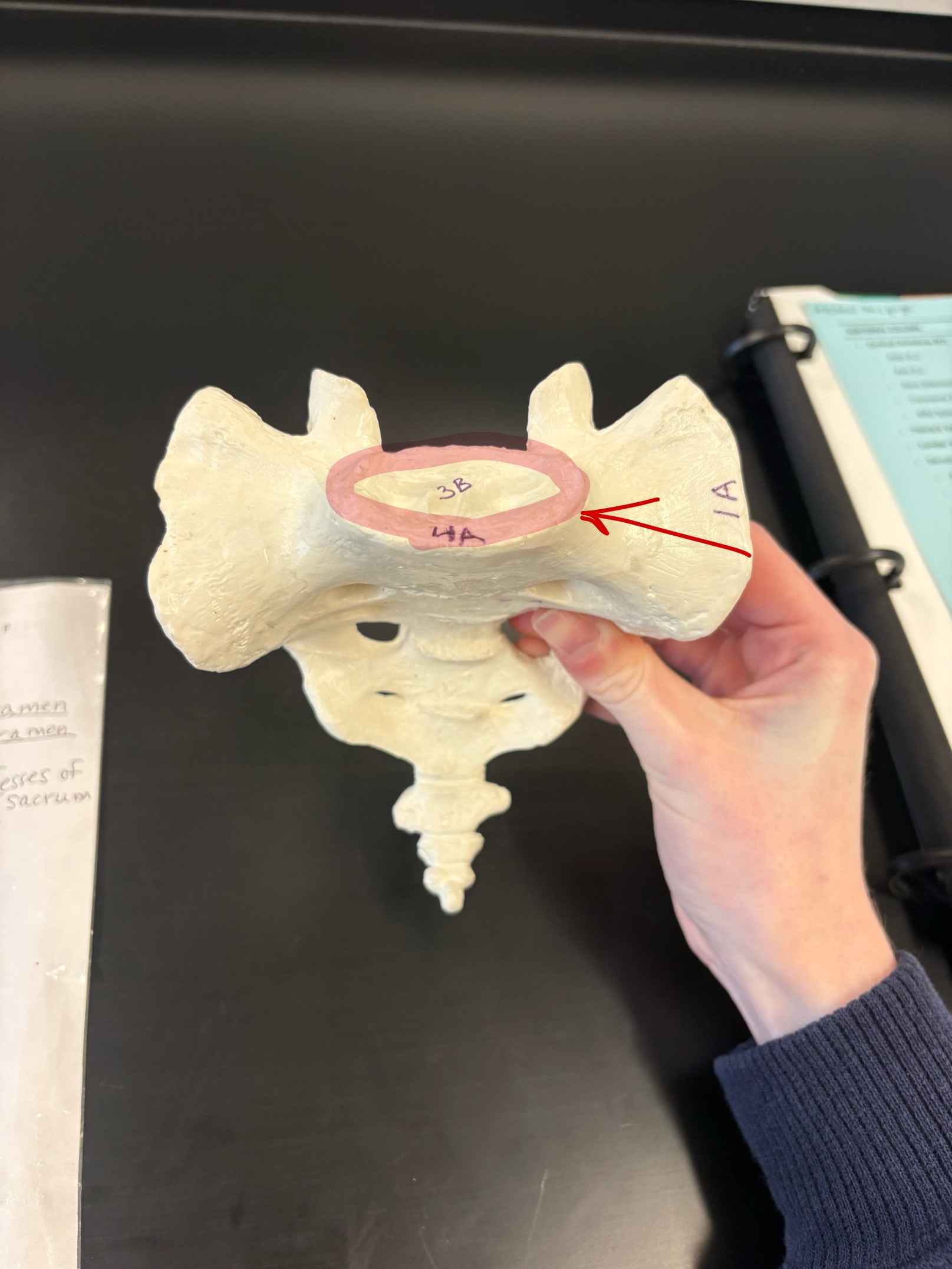 <p>Name this structure</p>