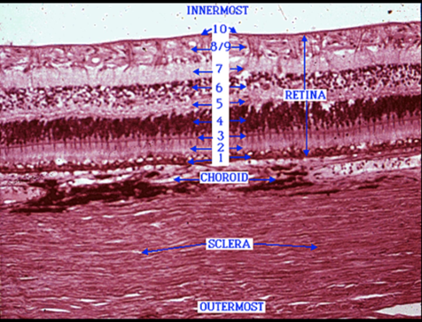 <p>Identify the layer of the retina (4) </p>