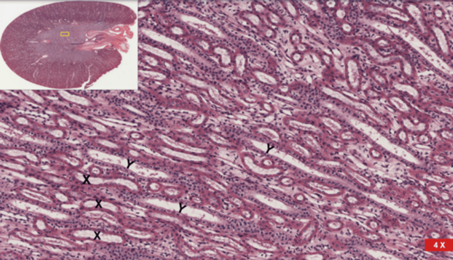 <p>Label the renal medulla</p>