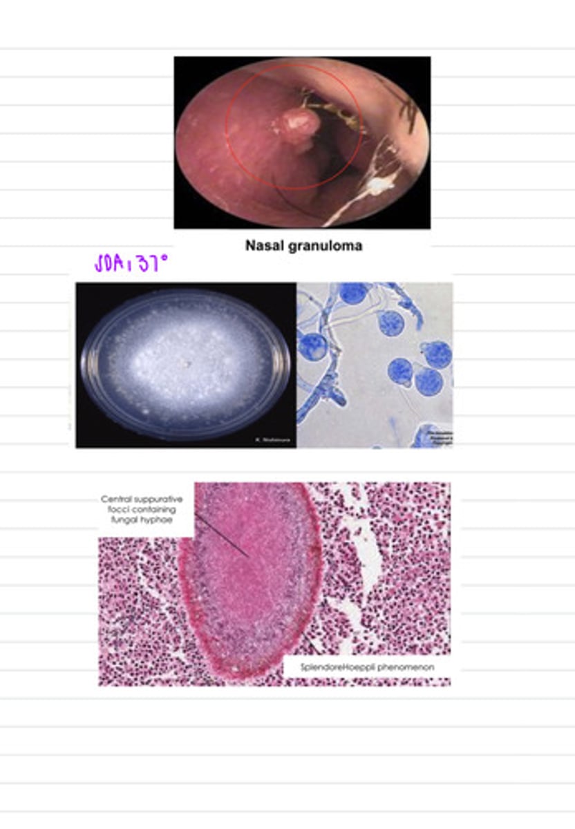 <p>a sheep is showing nasal granulomas, so we take a biopsy and grow the samples on SDA at 37 degrees. we also directly view a sample under a microscope. we find these results.</p><p>what is the diagnosis?</p>