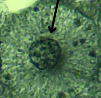 <p>What phase of mitosis is in this cell?</p>