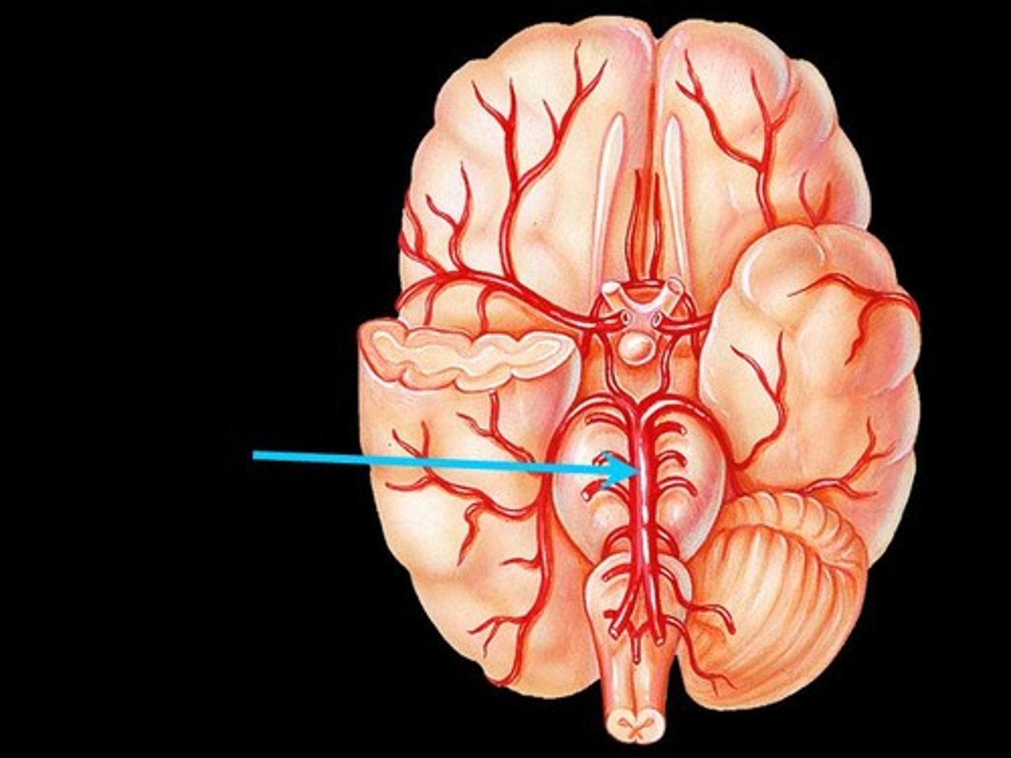 <p>Name the vessel indicated by blue arrow/coalescences from the left and right vertebral arteries</p>