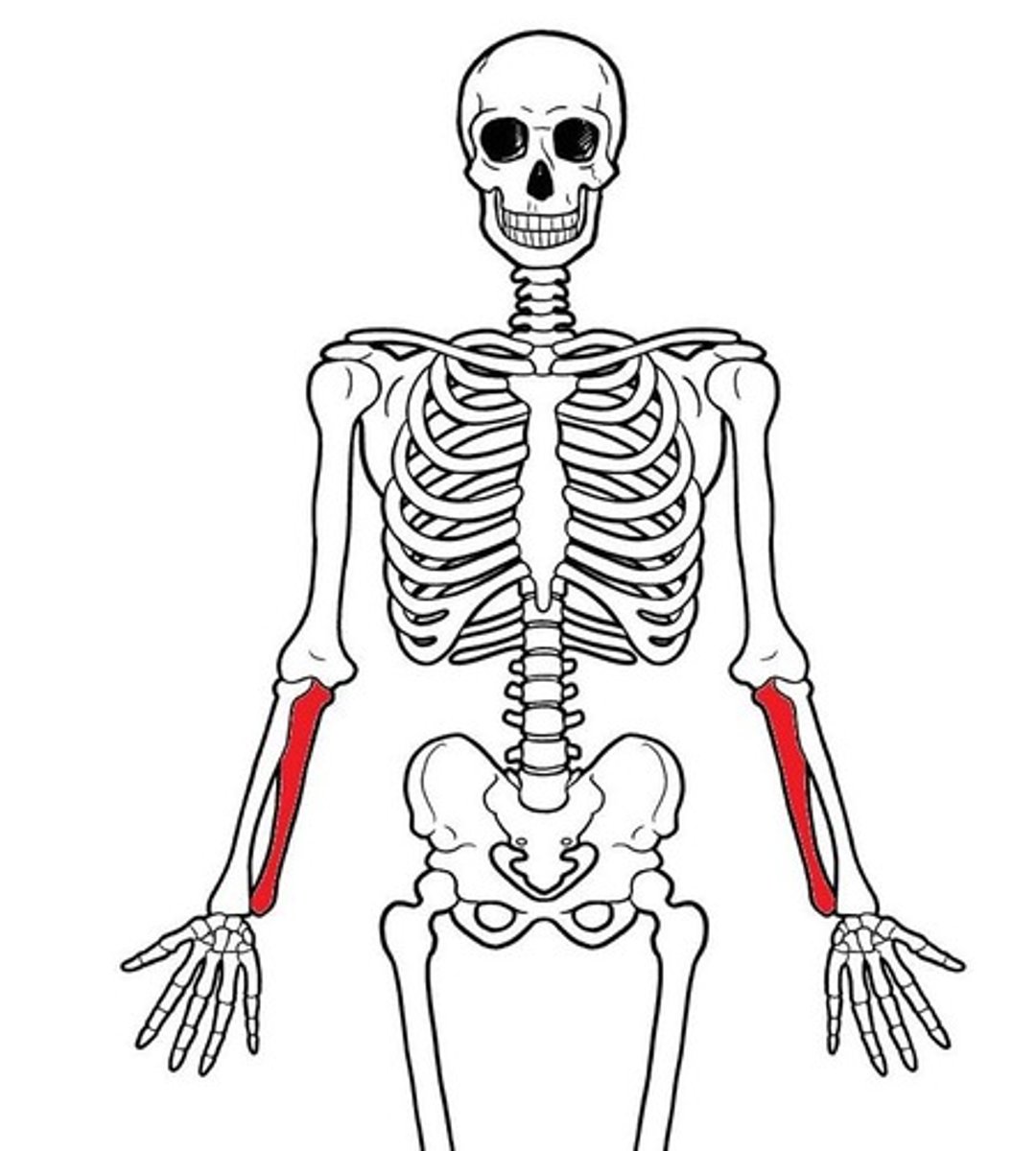 <p>ID red bone</p>