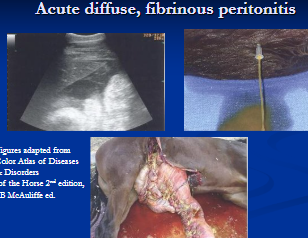 <p><span style="background-color: transparent;">Peritonitis</span></p>