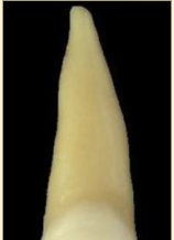 <p><mark data-color="blue" style="background-color: blue; color: inherit">maxillary central incisors #8 and #9; root apex</mark></p>