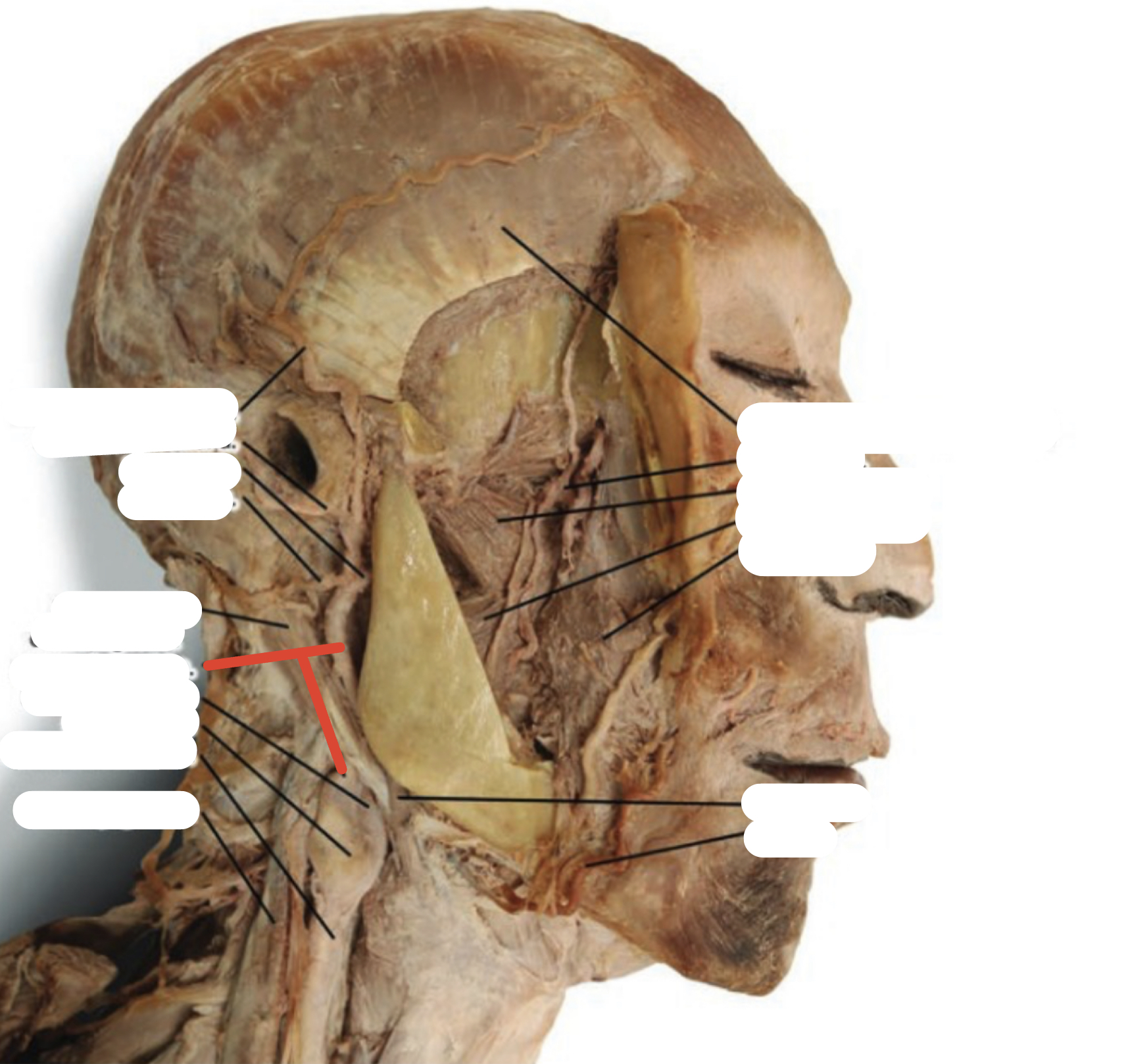 Identify the structure (red line)