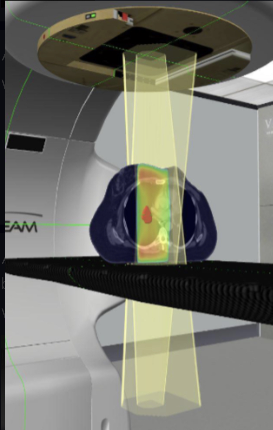 <p>What is the beam?</p>