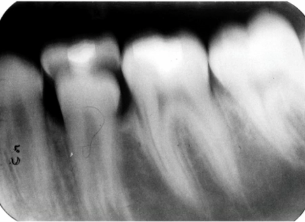 <p>would you consider this image diagnostic?</p>