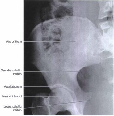 <p>AP OBLIQUE PROJECTION</p>