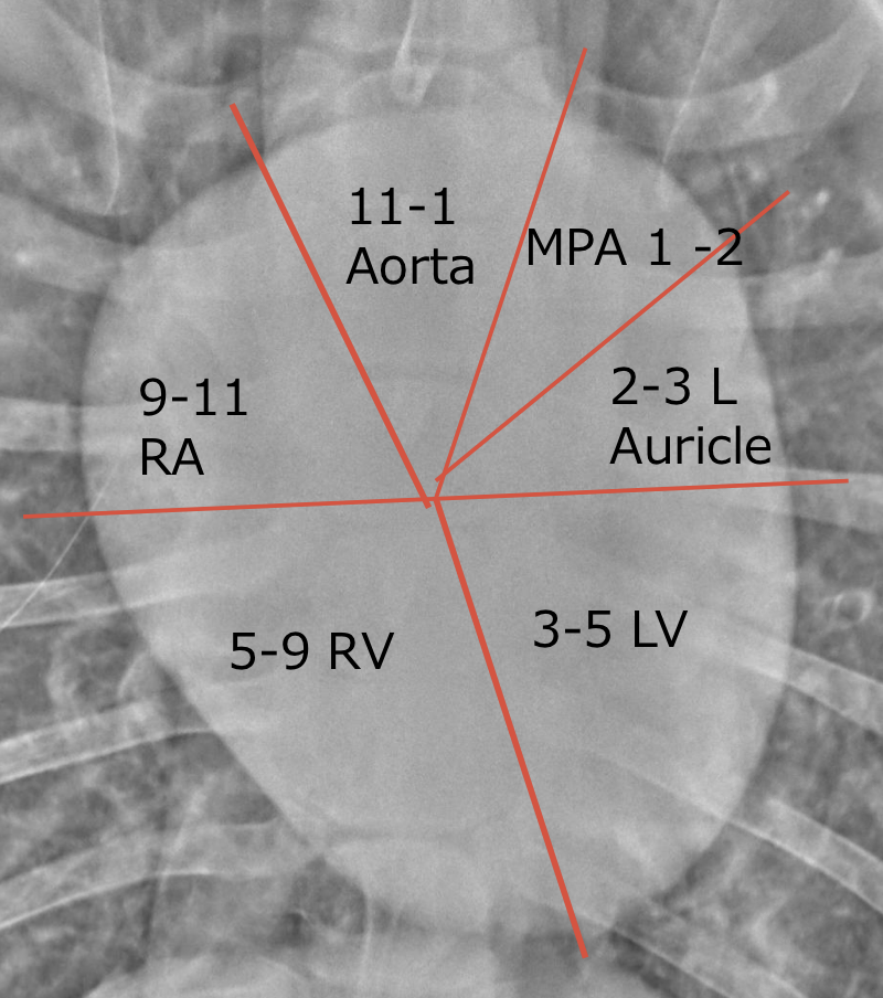 <p>seen on the image</p>