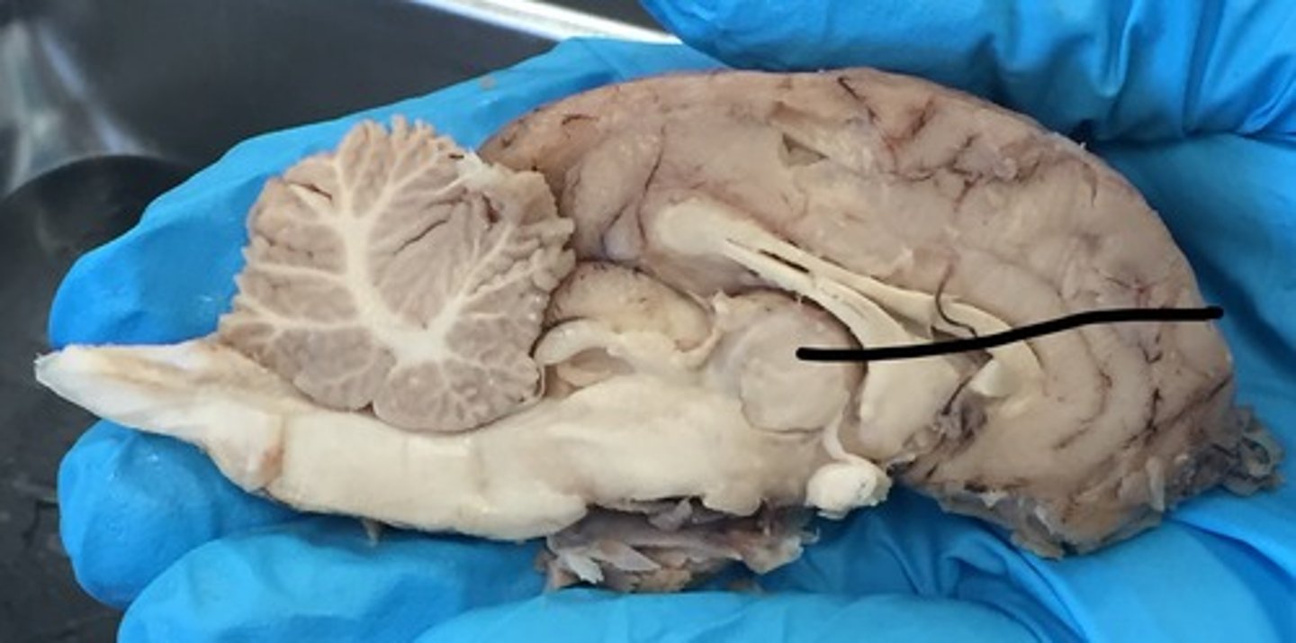 <p>directs messages to the sensory receiving areas in the cortex and transmits replies to the cerebellum and medulla; filters out excess stimuli; middle portion of the diencephalon</p>