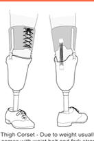 <p><span style="color: red;"><strong>Thigh corset</strong></span></p><ul><li><p>Redistributes some weight-bearing and torque forces to the <strong><u>thigh</u></strong></p></li></ul><p></p>