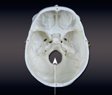 <p>opening in bone</p>