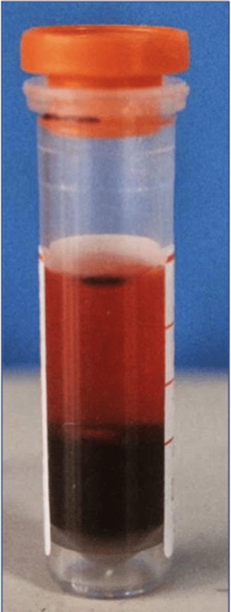 <p>interpretar esta muestra de sangre:</p>