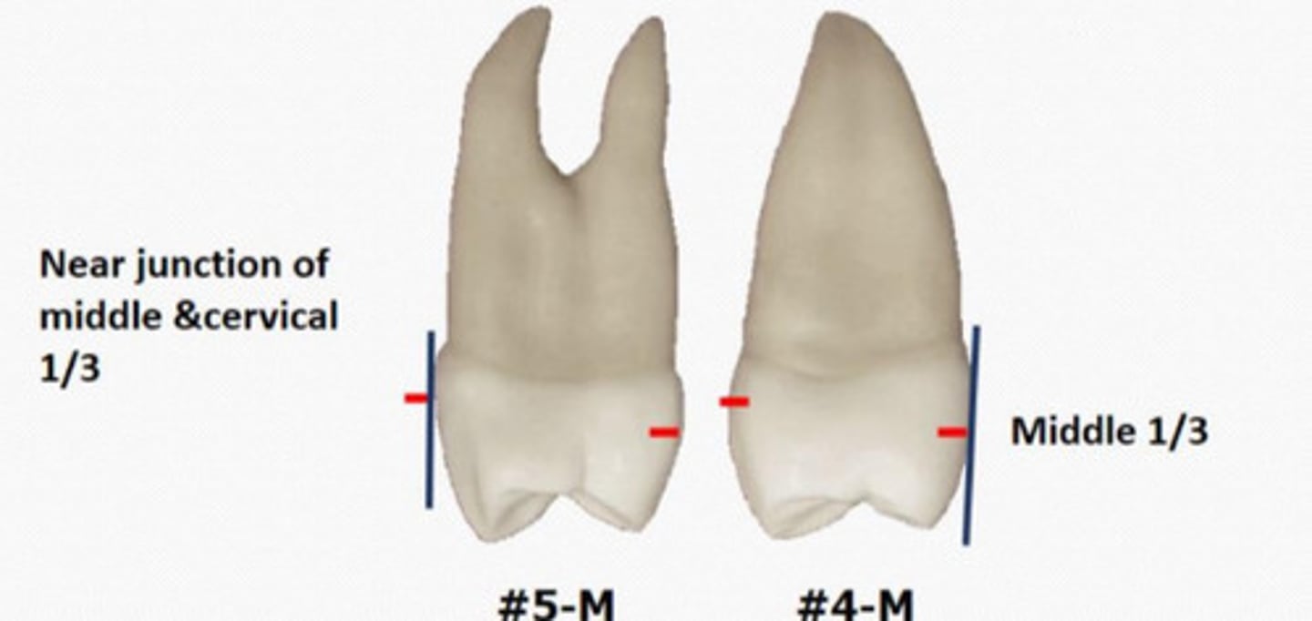 <p>Height of contour: Buccal located more cervical at the __</p>