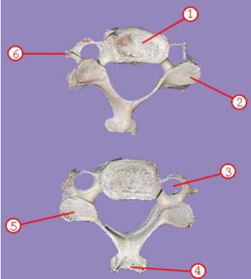<p><span>Name this type of vertebra</span></p>