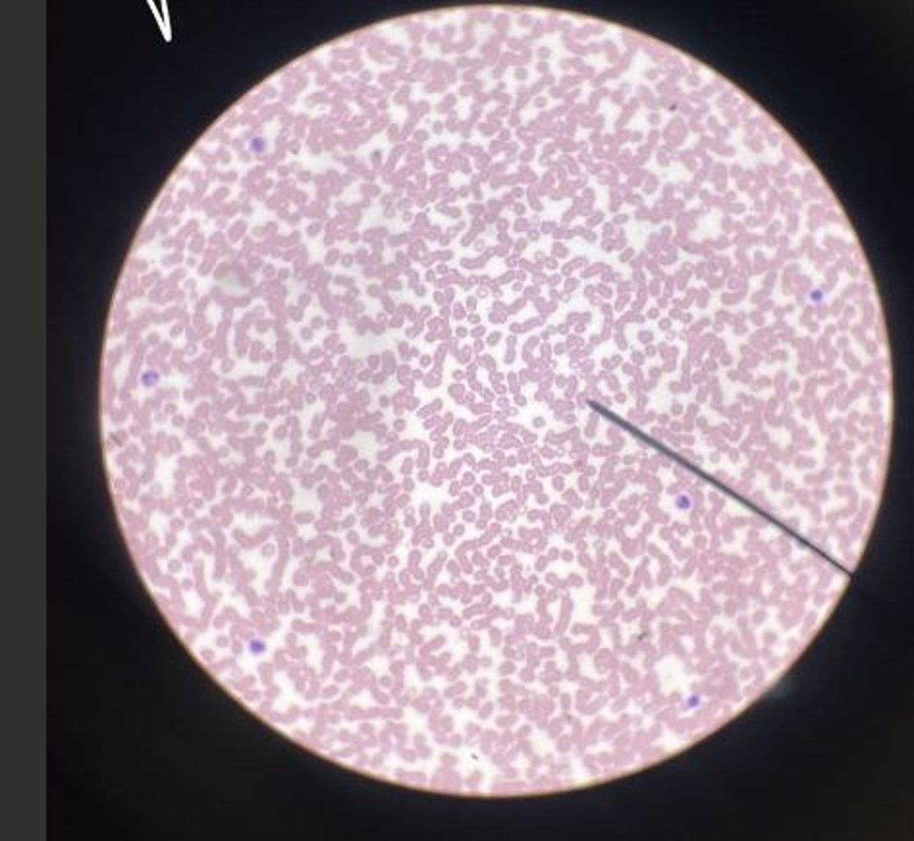 <p>Blood</p>